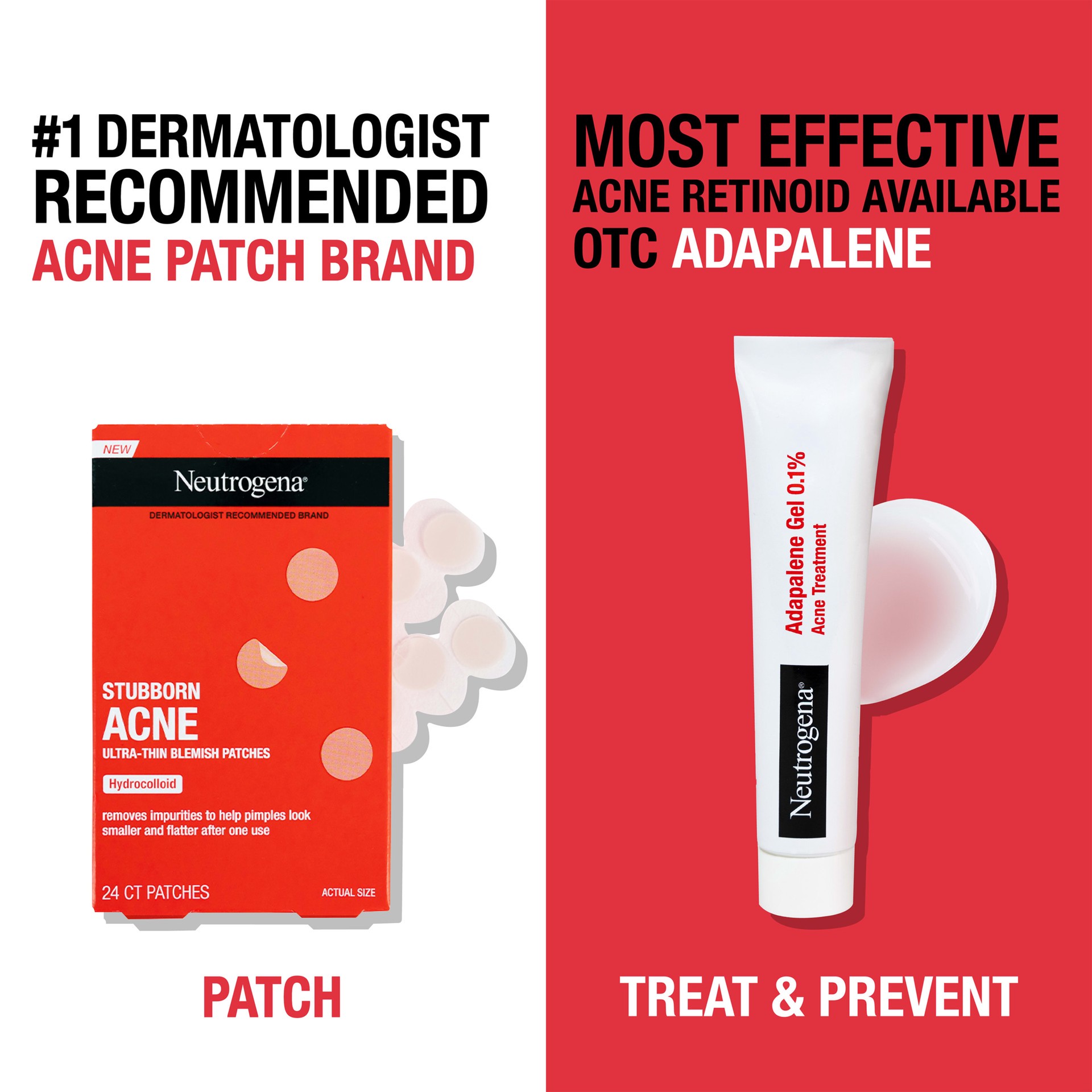 slide 6 of 9, Neutrogena Acne Treatment 1.6 oz, 1.6 oz