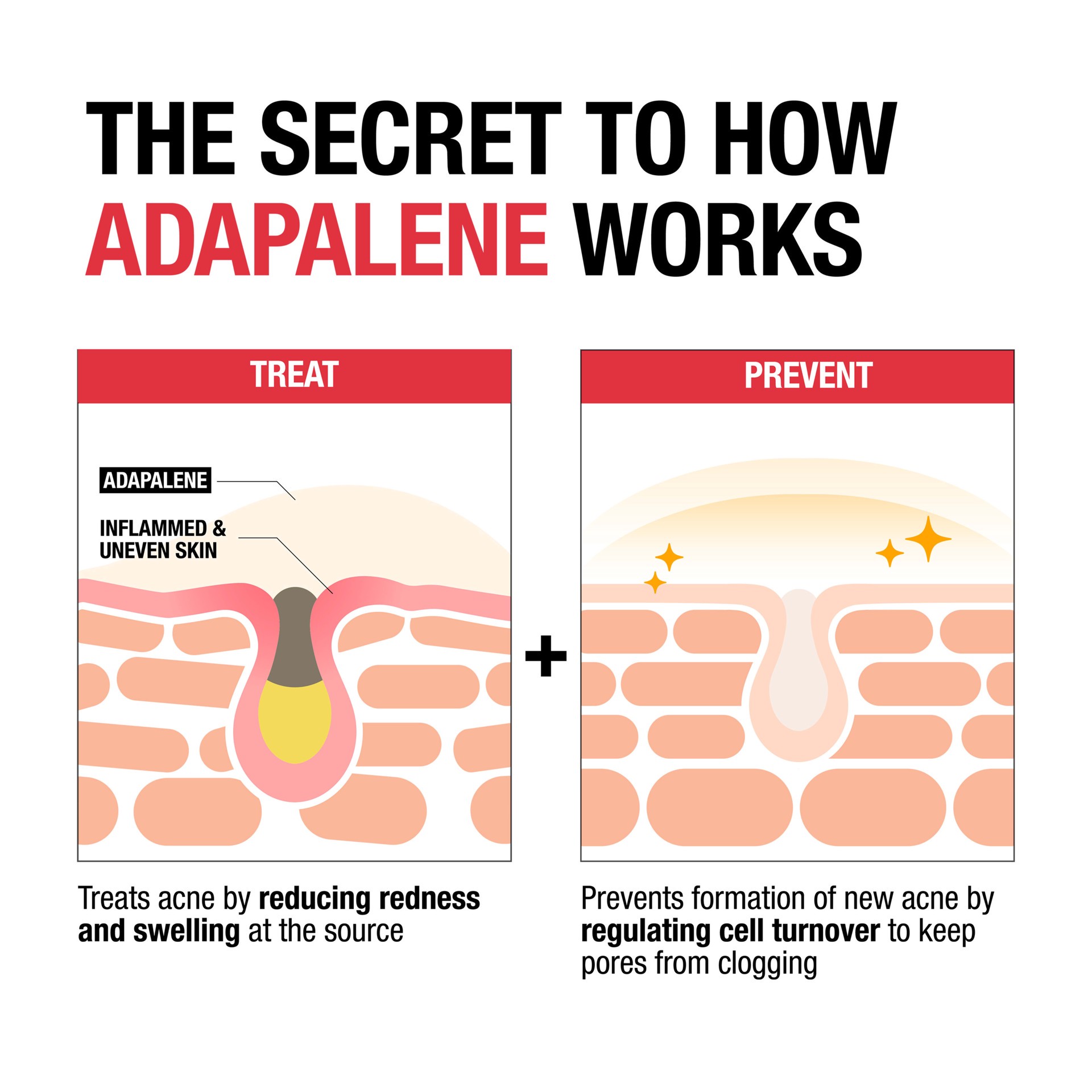slide 4 of 9, Neutrogena Acne Treatment 1.6 oz, 1.6 oz