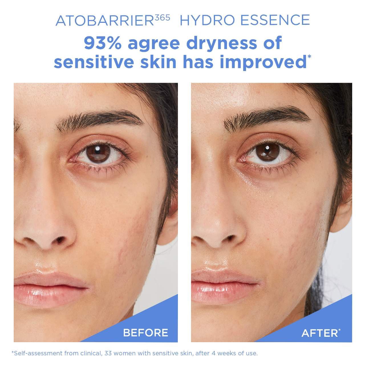 slide 6 of 9, AESTURA ATOBARRIER365 Hydro Essence with Hydrating Amino Acids for Skin Moisture Barrier Repair 6.76 oz / 200 mL, 6.76 oz / 200 ml
