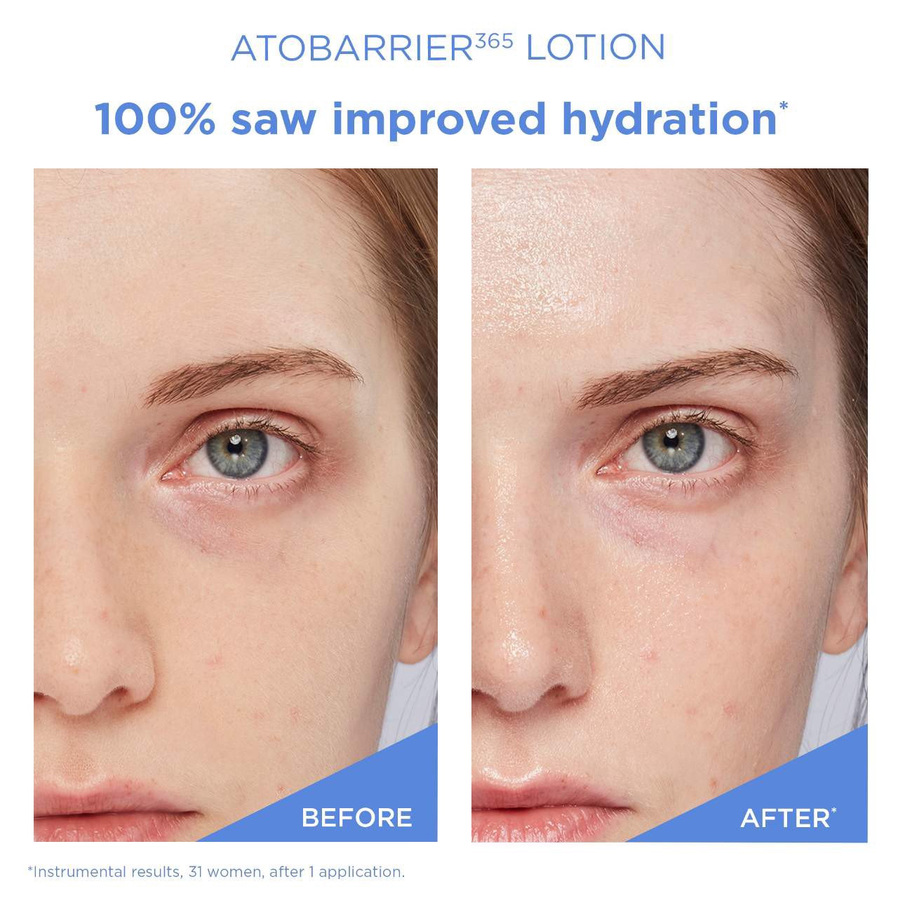slide 6 of 10, AESTURA ATOBARRIER365 Lightweight Face Lotion Moisturizer with Ceramides & Niacinamide for Skin Moisture Barrier Repair 5.07 oz / 150 mL, 5.07 oz / 150 ml