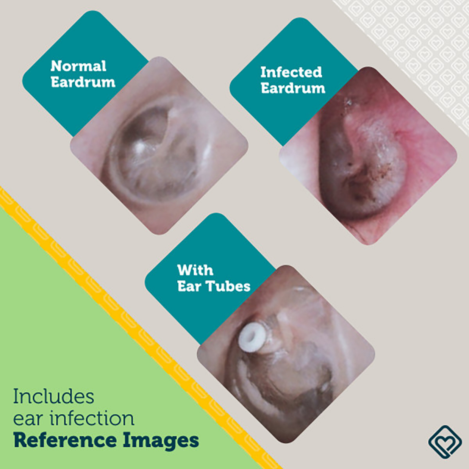 slide 6 of 6, Safety 1st Ear Otoscope, 1 ct