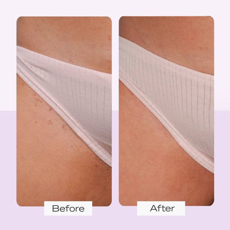 slide 6 of 9, FIRST AID BEAUTY Ingrown Hair Pads - 60ct - Ulta Beauty, 60 ct