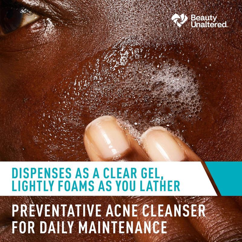 slide 8 of 9, CeraVe Acne Face Cleanser with 2% Salicylic Acid and Purifying Clay for Oily Skin - 16 fl oz, 16 fl oz