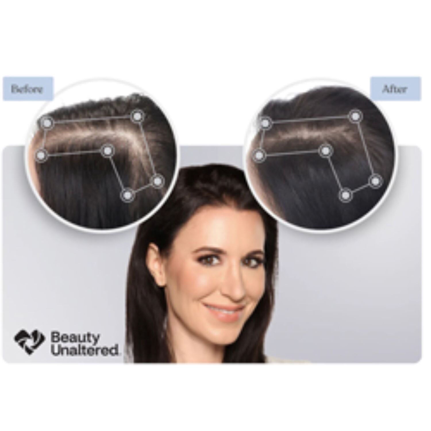 slide 2 of 4, Keranique Hair Regrowth System, 1 ct