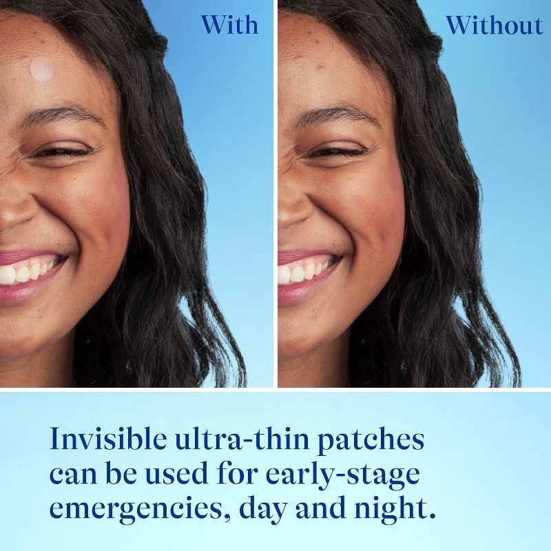 slide 9 of 11, Differin Fast Fix Salicylic Acid Pimple Patches for Emerging Acne - 36ct, 36 ct