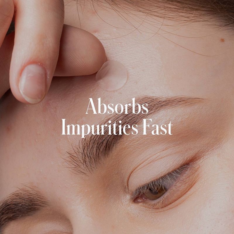 slide 4 of 7, Geologie Clear System Anti-Pimple Pack - Acne Hydrocolloid Patches & Spot Treatment - 20ct + 15ml, 20 ct, 15 ml