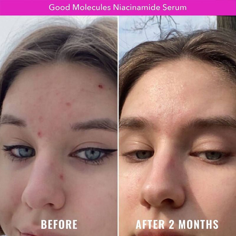 slide 4 of 5, Good Molecules Niacinamide Face Serum - 1 fl oz, 1 fl oz