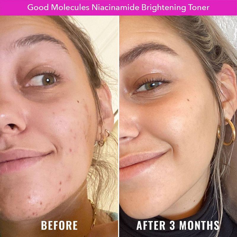 slide 4 of 5, Good Molecules Niacinamide Brightening Face Toner - 4 fl oz, 4 fl oz