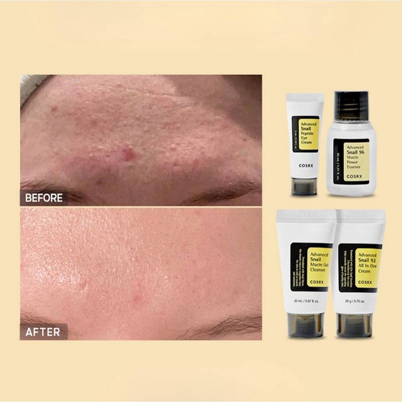 slide 6 of 7, COSRX All About Snail Skincare Kit - 4pc - Ulta Beauty, 4 ct