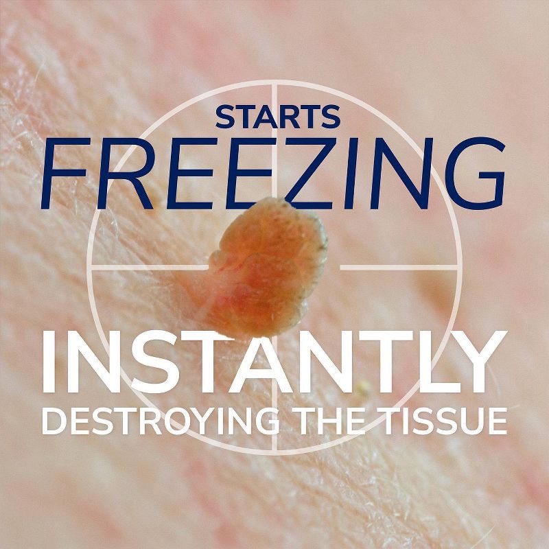slide 5 of 10, Dr. Scholl's Freeze Away Skin Tag Remover - 1.8oz, 1.8 oz