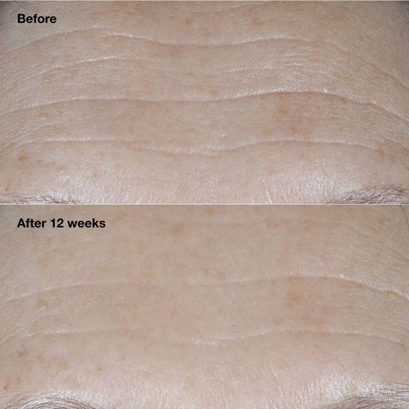 slide 3 of 13, Clinique Smart Clinical Repair Broad Spectrum Wrinkle Correcting Cream - SPF 30 - 1.7oz - Ulta Beauty, 30 ct; 1.7 oz