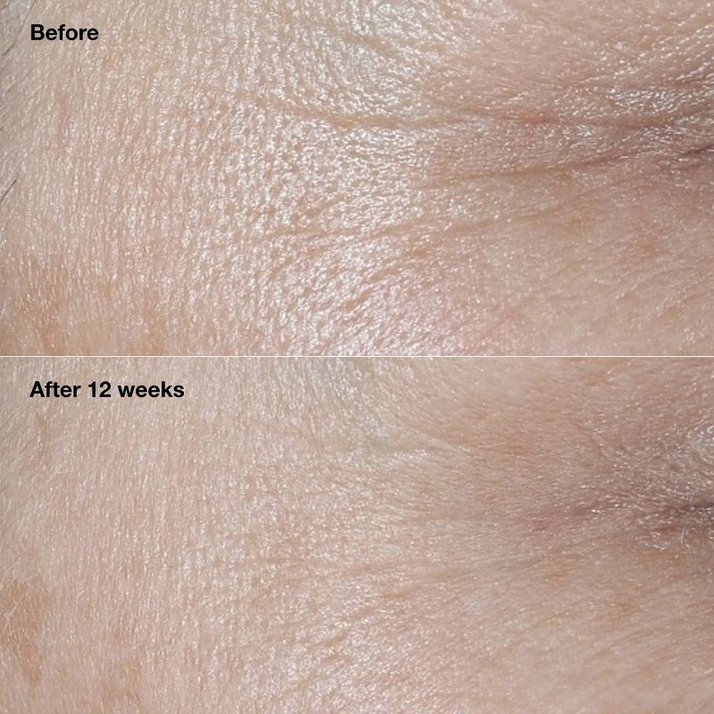 slide 4 of 13, Clinique Smart Clinical Repair Broad Spectrum Wrinkle Correcting Cream - SPF 30 - 1.7oz - Ulta Beauty, 30 ct; 1.7 oz