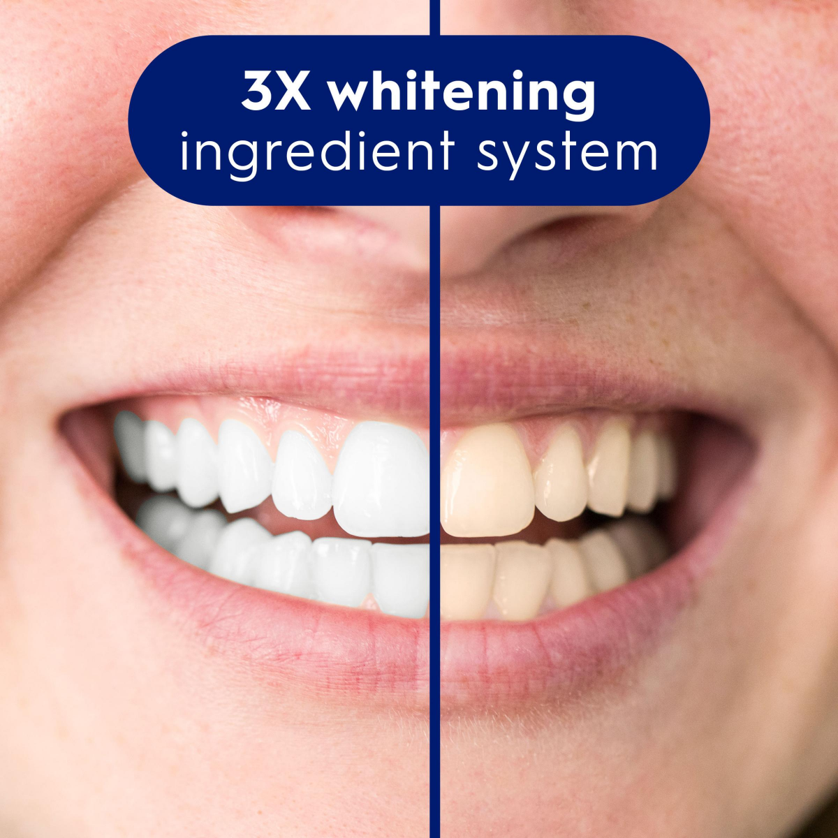 slide 11 of 25, Crest 3D White Brilliance Pro Ultra White Teeth Whitening Toothpaste, 3.8 oz, Anticavity Fluoride Toothpaste, 4% Hydrogen Peroxide, Active Whitening Protection, 3.8 oz