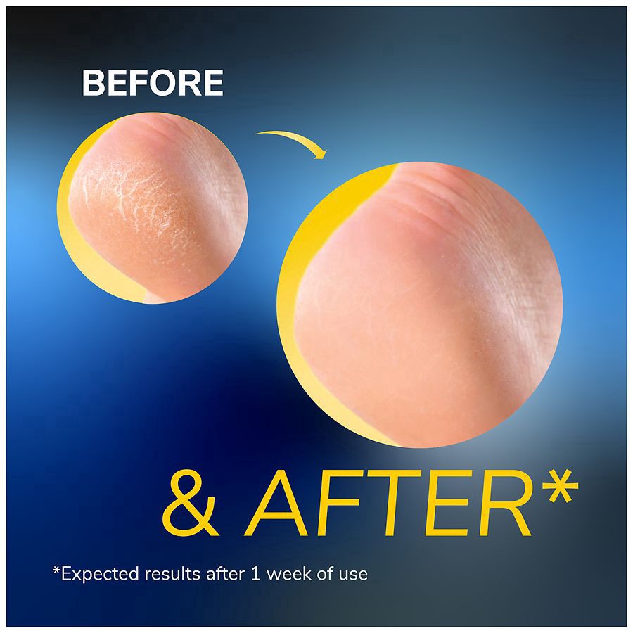 slide 4 of 5, Dr. Scholl's Dry, Cracked Skin Relief Hydrating Balm - Safe for Diabetics, 2.5 oz