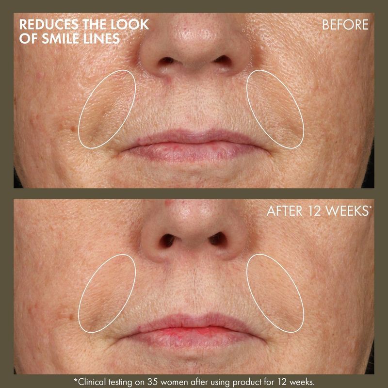 slide 4 of 10, Origins Plantscription Active Wrinkle Correcting Serum with Retinoid - 1.01 fl oz - Ulta Beauty, 1.01 fl oz