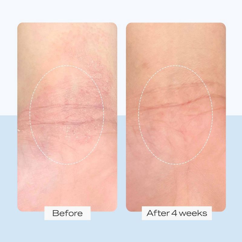 slide 8 of 8, FIRST AID BEAUTY Women's Sensitive Skin Starter Kit - 3pc - Ulta Beauty, 3 ct