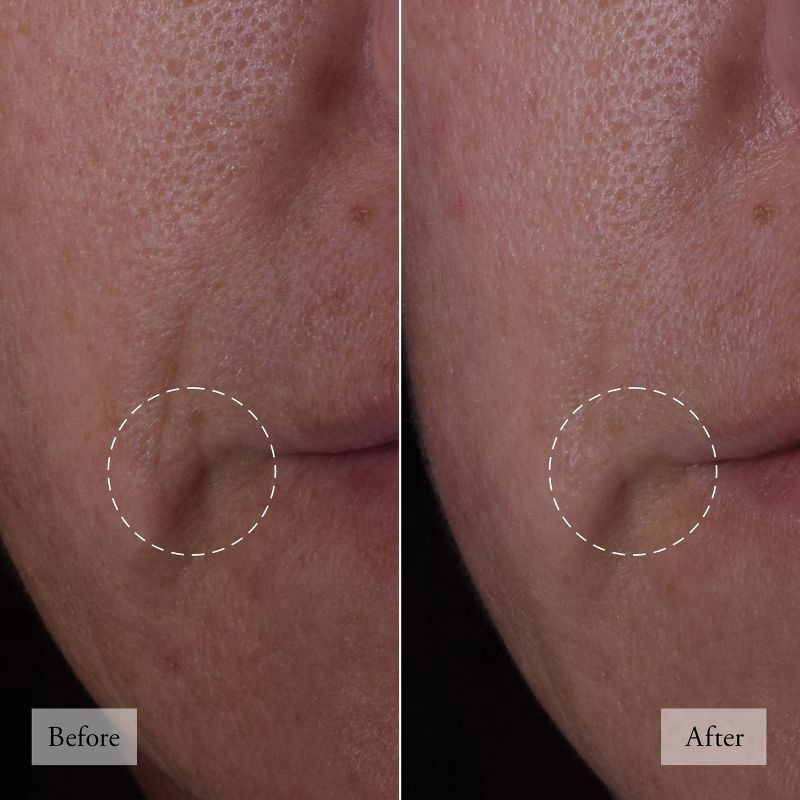 slide 4 of 10, philosophy Dose of Wisdom Bouncy Skin Reactivating Serum - 1 fl oz - Ulta Beauty, 1 fl oz