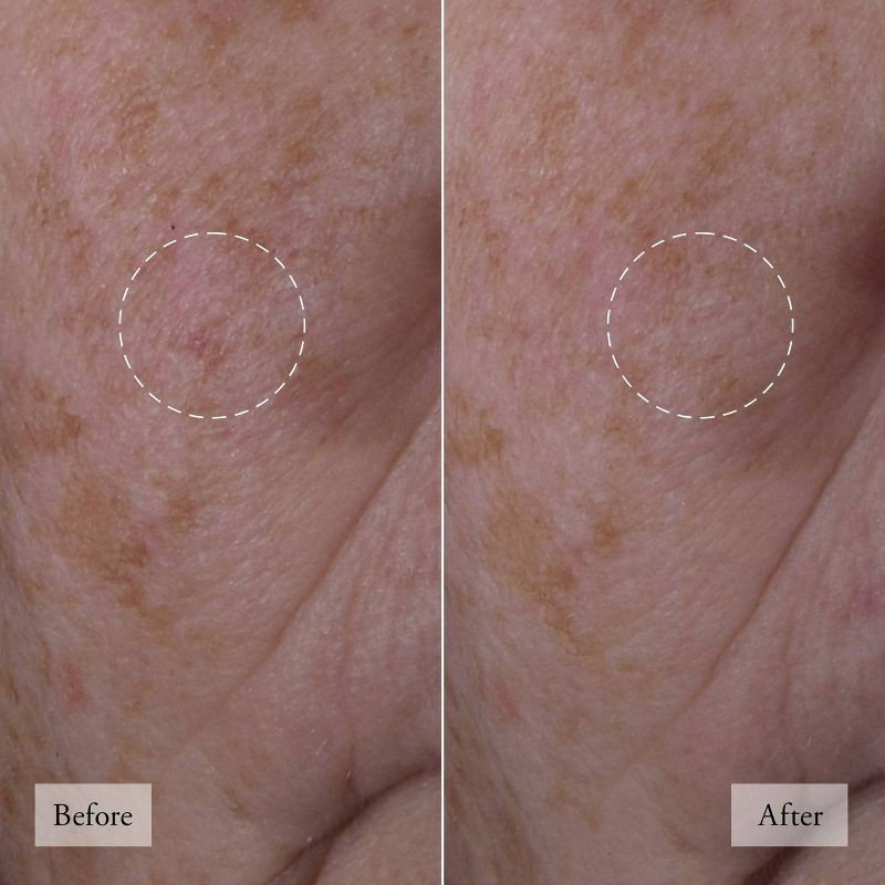 slide 5 of 10, philosophy Dose of Wisdom Bouncy Skin Reactivating Serum - 1 fl oz - Ulta Beauty, 1 fl oz