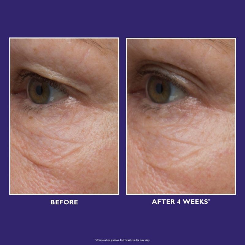 slide 6 of 7, PETER THOMAS ROTH Ultimate Solution 5 Multitasking Eye Cream - 0.5 fl oz - Ulta Beauty, 0.5 fl oz