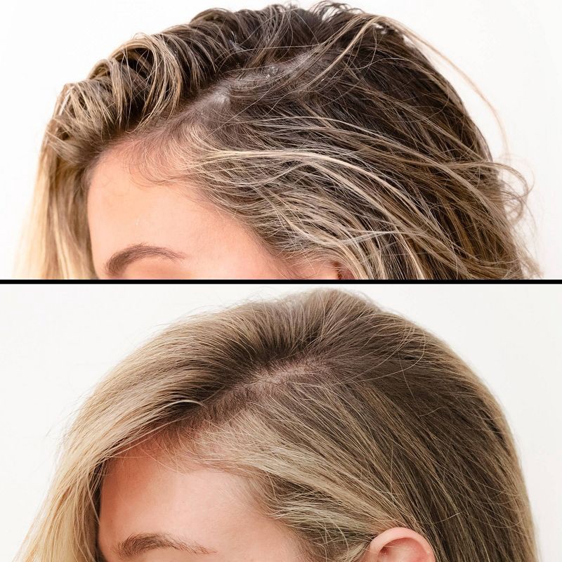 slide 3 of 6, IGK First Class Charcoal Detox Dry Shampoo - 6.3oz - Ulta Beauty, 6.3 oz