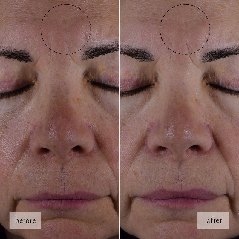 slide 4 of 11, philosophy HIAJ Face Moisturizer - Travel Size - 0.5 fl oz - Ulta Beauty, 0.5 fl oz