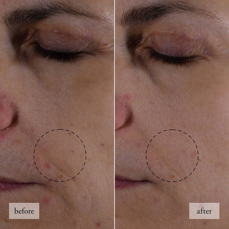 slide 5 of 11, philosophy HIAJ Face Moisturizer - Travel Size - 0.5 fl oz - Ulta Beauty, 0.5 fl oz