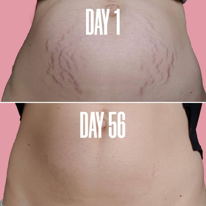 slide 3 of 5, MAELYS B-Flat Belly Firming Cream - 3.38oz - Ulta Beauty, 3.38 oz