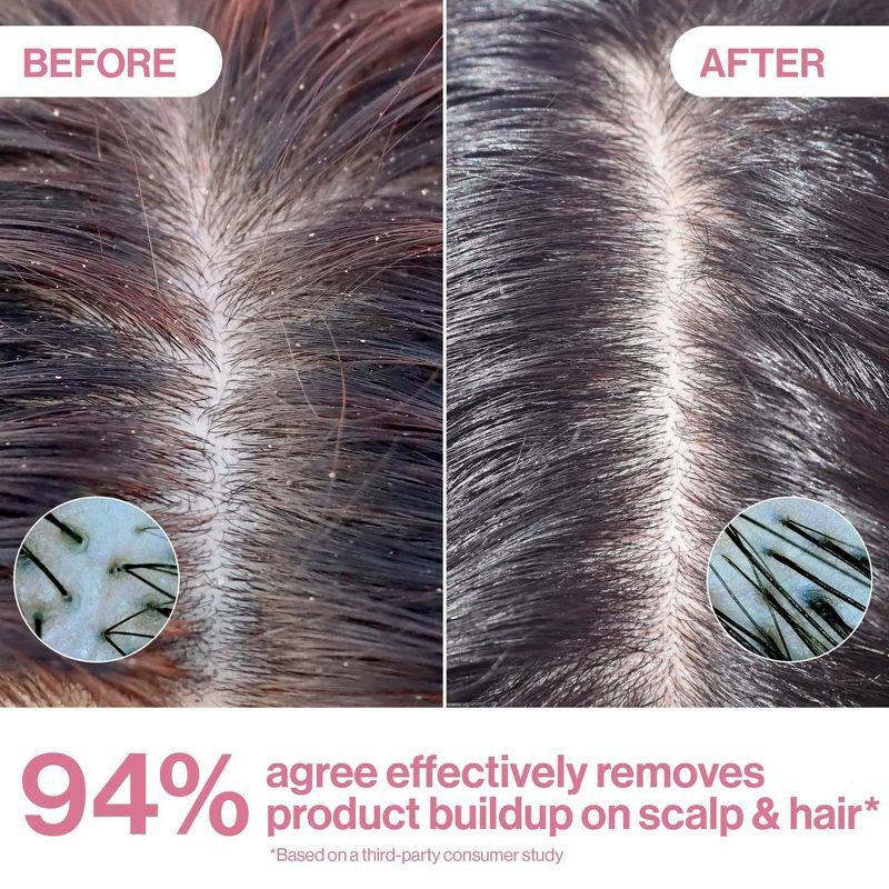 slide 7 of 8, Rizos Curls Apple Cider Vinegar Scalp & Hair Rinse - 10 fl oz, 10 fl oz