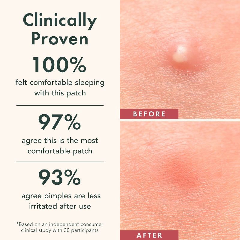 slide 4 of 7, Rael Beauty Miracle Pimple Patches Day & Night Duo Pack - 38ct, 38 ct