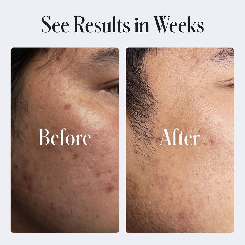 slide 5 of 9, Geologie Clear System Skin Repair Moisturizer - 0.2% Retinol - 2 fl oz, 2 fl oz
