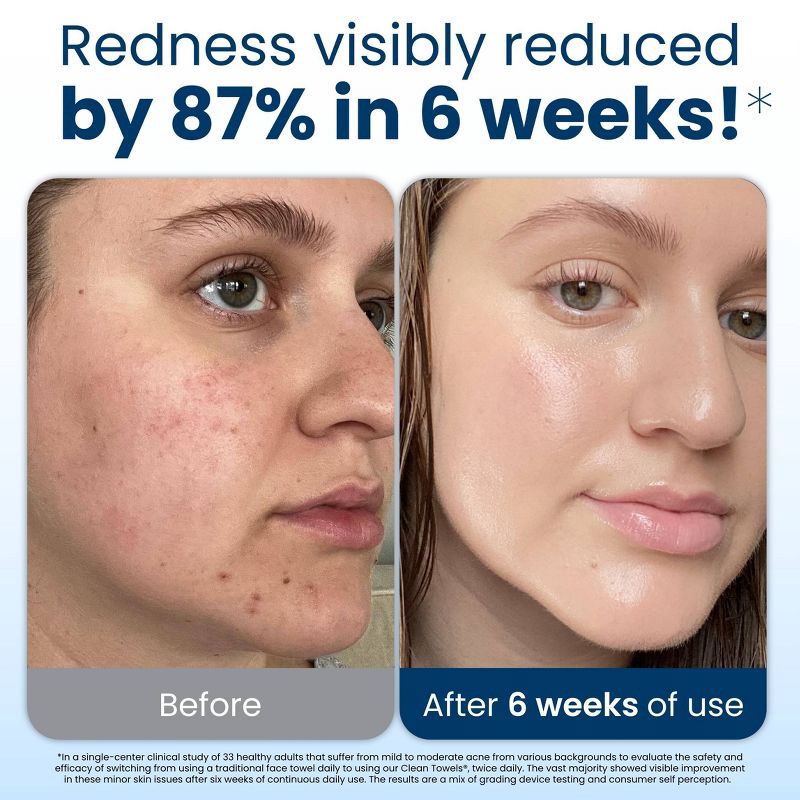 slide 3 of 12, Clean Skin Club Disposable Face Towel for Improved Skin - XL - 50ct, 50 ct