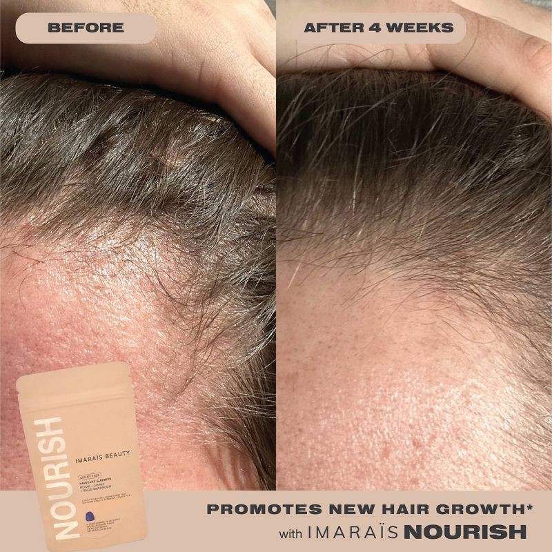 slide 6 of 7, Imarais Beauty Nourish Haircare Gummies for Hair Growth, Anti-Shedding - Vegan and Sugar-Free - 30ct, 30 ct