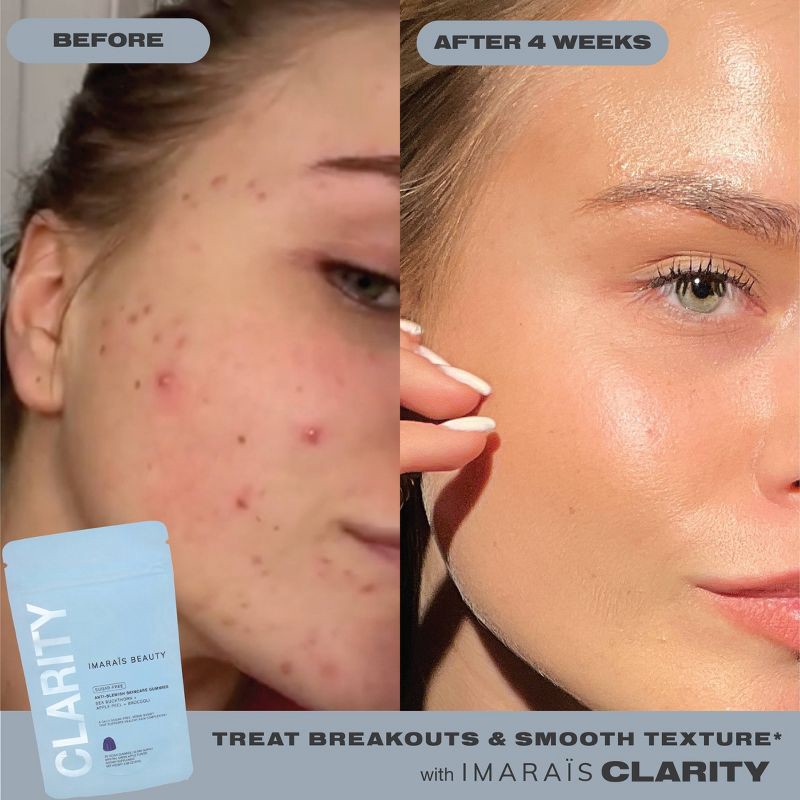 slide 6 of 7, Imarais Beauty Clarity Anti-Blemish Gummies for Clear Complexion - Vegan and Sugar-Free - 30ct, 30 ct