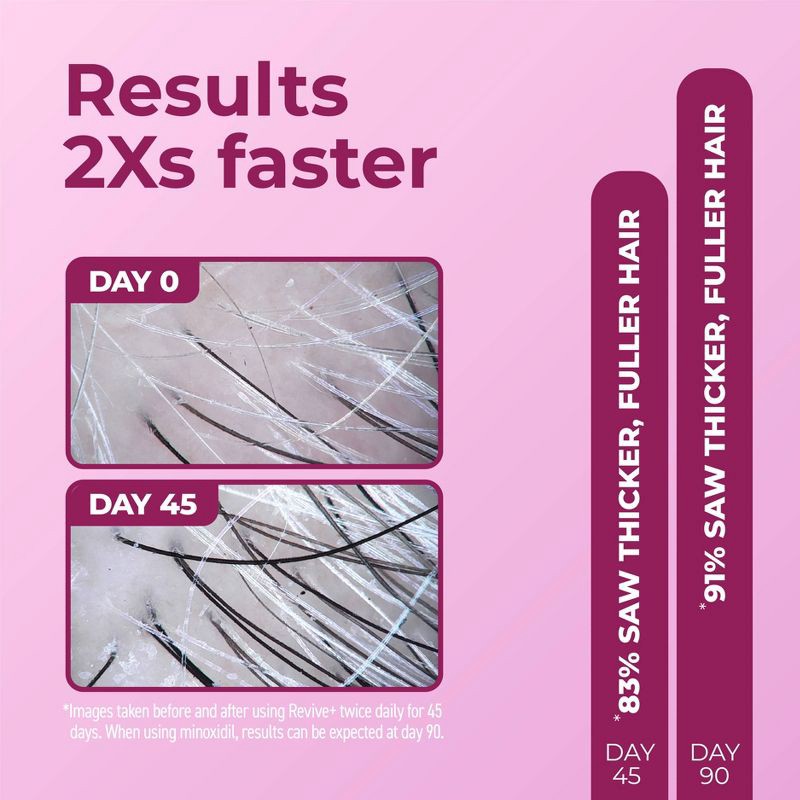 slide 4 of 9, BosleyMD Revive + Densifying Hair Regrowth Serum for Women - 1 fl oz, 1 fl oz