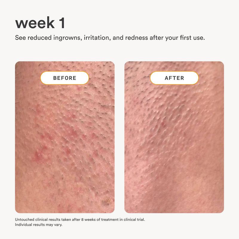 slide 4 of 9, Nood After Care Serum - 3.3 fl oz, 3.3 fl oz