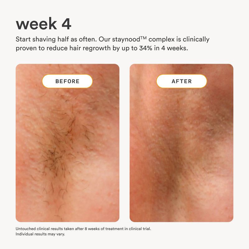 slide 5 of 9, Nood After Care Serum - 3.3 fl oz, 3.3 fl oz