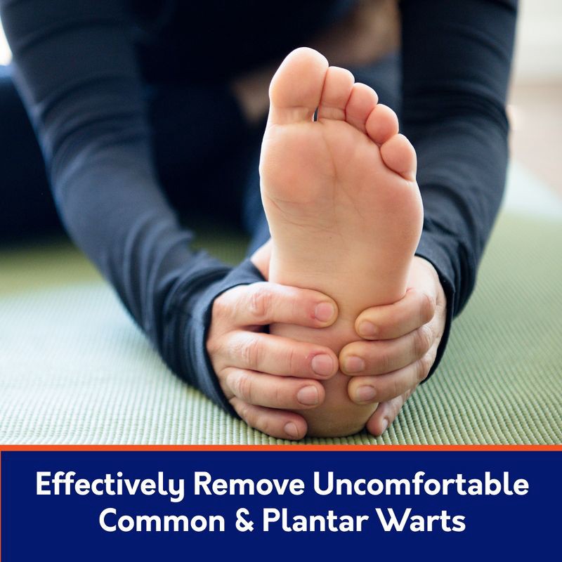 slide 6 of 8, Compound W Freeze Off with Cushion Discs - Wart Remover Treatment - 8 Applications + 12 Discs, 1 ct