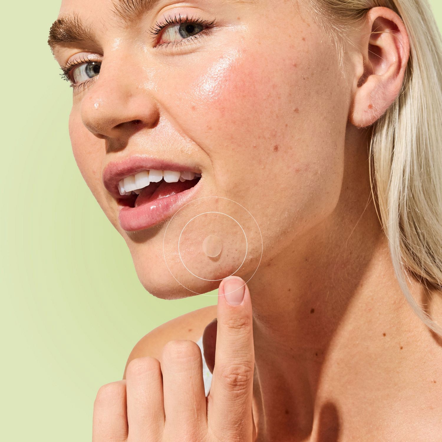 slide 3 of 7, Zitsticka Undercover Ultra Sheer Blemish Patches, 30 Ct, 36 ct