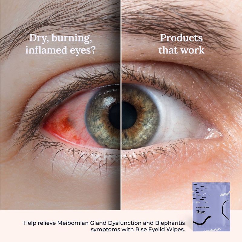 slide 5 of 6, CorneaCare Rise, Cleansing & Moisturizing Eyelid Wipes with Hyaluronic Acid for Dry Eye Relief - 15ct, 15 ct