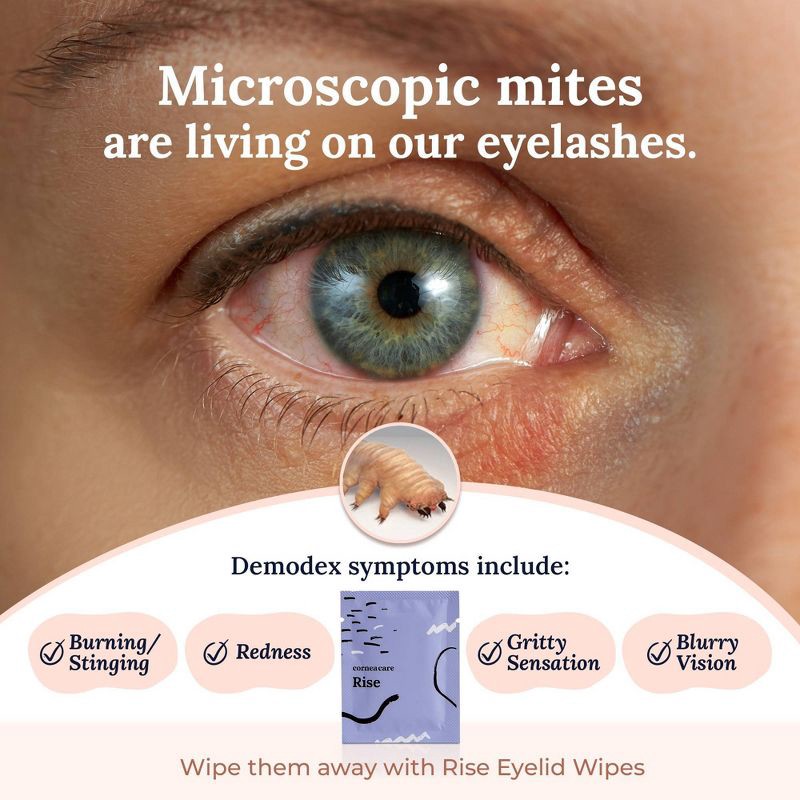 slide 6 of 6, CorneaCare Rise, Cleansing & Moisturizing Eyelid Wipes with Hyaluronic Acid for Dry Eye Relief - 15ct, 15 ct