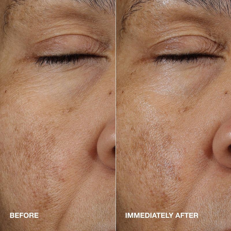 slide 8 of 11, Clinique Moisture Surge Active Glow Serum - 1 fl oz - Ulta Beauty, 1 fl oz