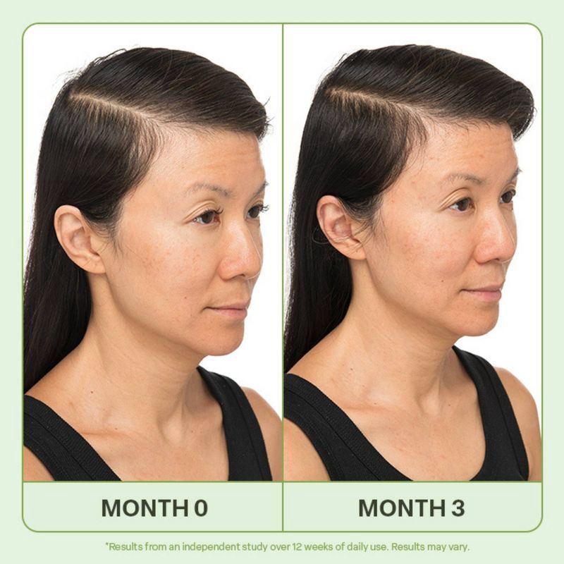 slide 3 of 6, Divi Mini Scalp Serum - 0.5 fl oz - Ulta Beauty, 0.5 fl oz