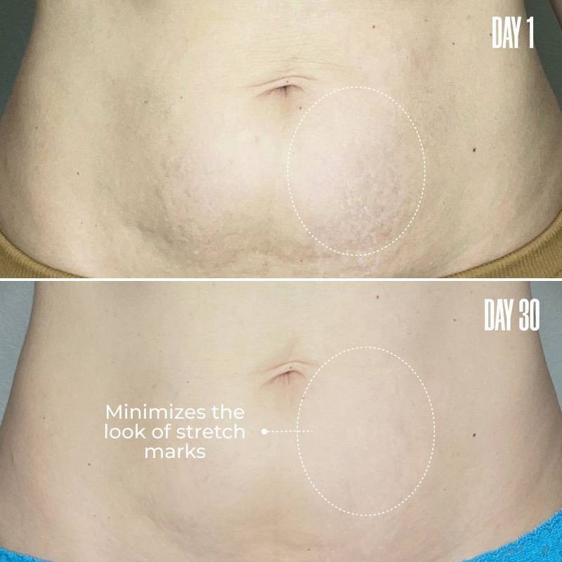 slide 4 of 8, MAELYS Re-Lure Tight and Tone Body Serum - 3.5 fl oz - Ulta Beauty, 3.5 fl oz