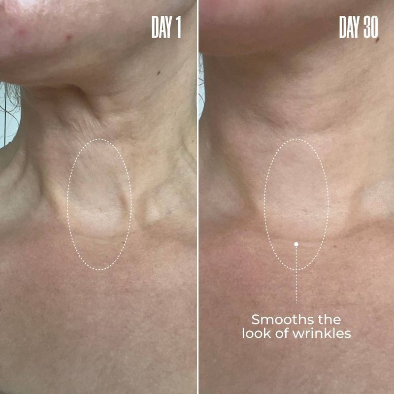 slide 3 of 7, MAELYS B-Poised Neck and Decollete Cream - Ulta Beauty, 1 ct