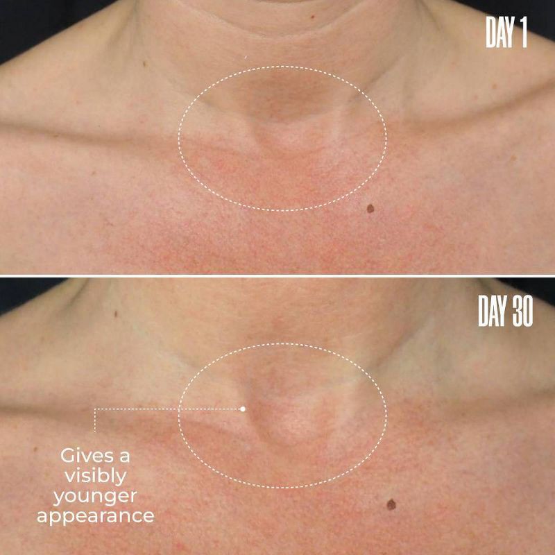 slide 4 of 7, MAELYS B-Poised Neck and Decollete Cream - Ulta Beauty, 1 ct