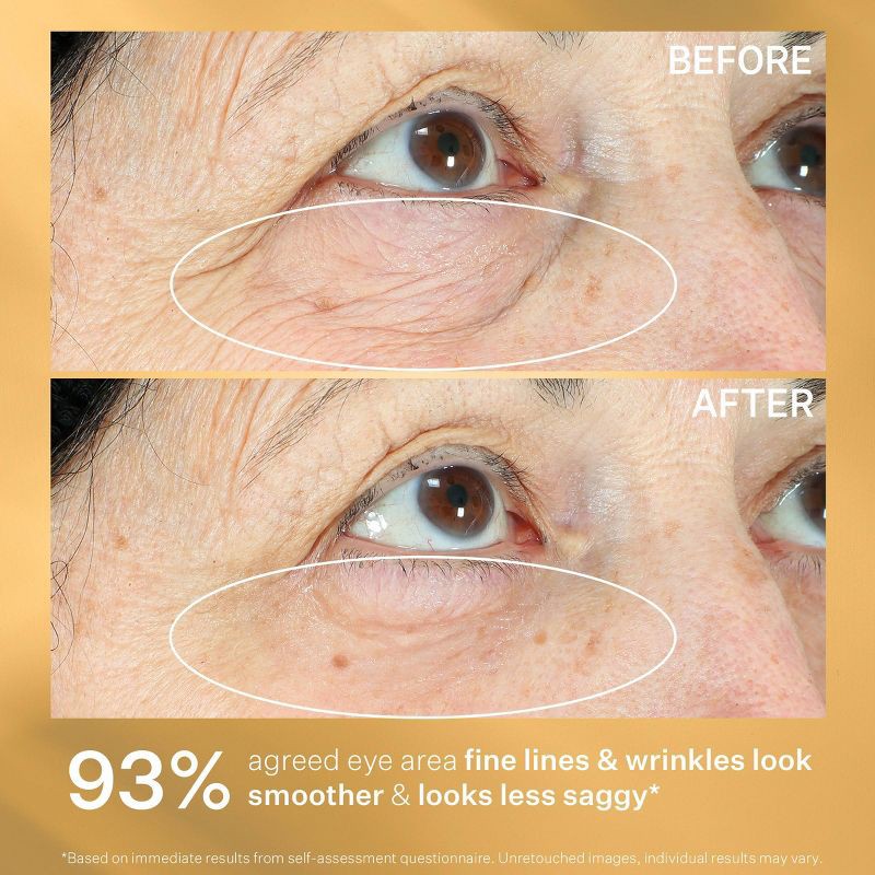 slide 7 of 7, StriVectin Hyperlift Eye Instant Eye Fix - 0.34oz - Ulta Beauty, 0.34 oz