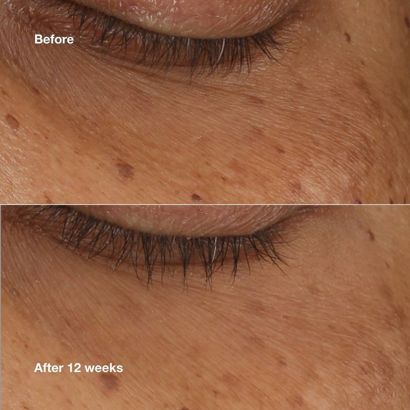 slide 7 of 9, Clinique All About Eyes Brightening Serum - 10ml - Ulta Beauty, 10 ml