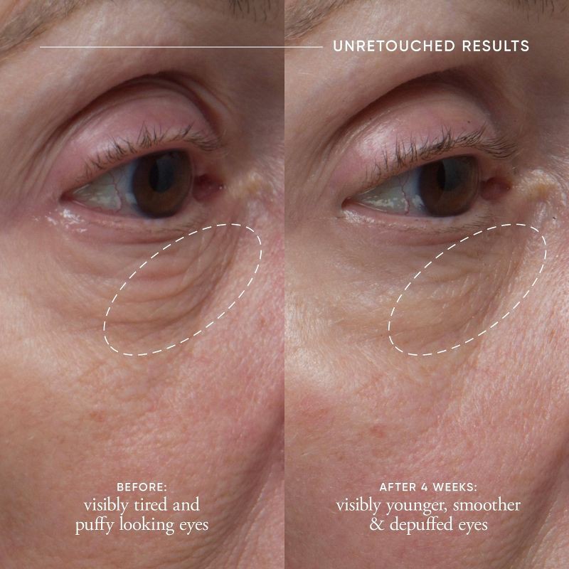 slide 4 of 10, philosophy Dose of Wisdom Dark Circle Eye Cream - 0.5 fl oz - Ulta Beauty, 0.5 fl oz