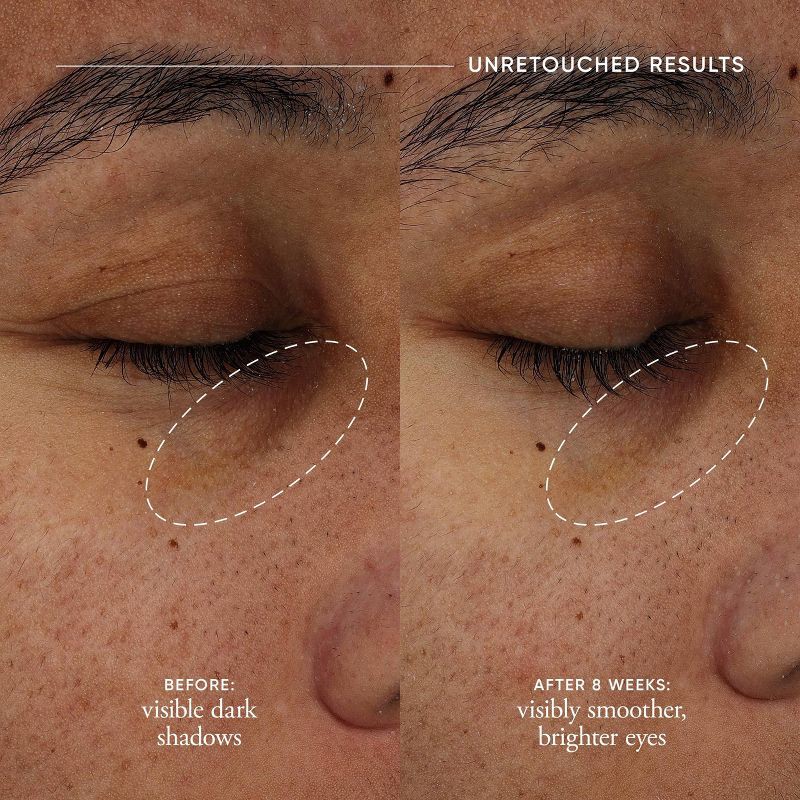 slide 5 of 10, philosophy Dose of Wisdom Dark Circle Eye Cream - 0.5 fl oz - Ulta Beauty, 0.5 fl oz