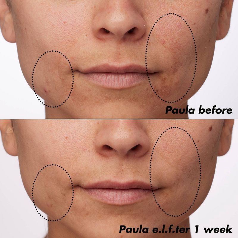 slide 3 of 14, e.l.f. SKIN PLZ Clarify Facial Oil - 2% Salicylic Acid Acne Treatment + Aloe Extract - 1 fl oz, 1 fl oz
